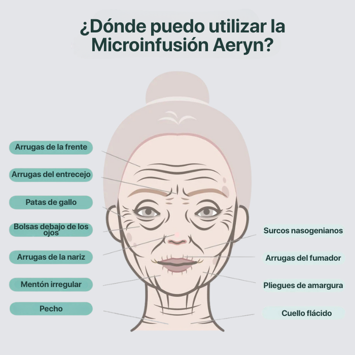 El Sistema de Microinfusión™
